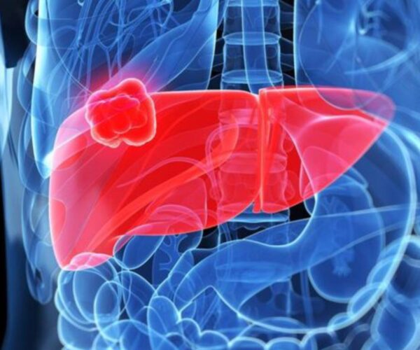 livercancer livercancer